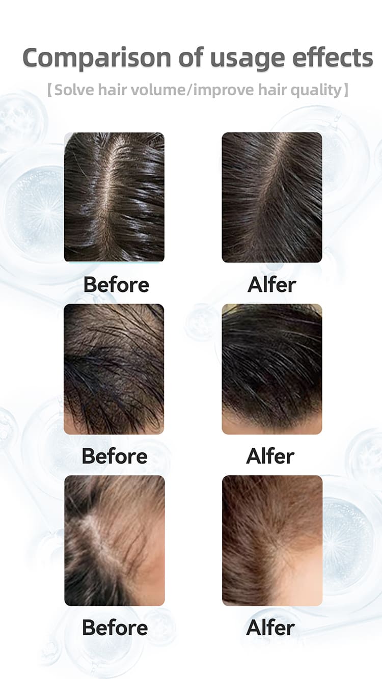 style tree caffeine anti hair loss shampoo – thinning hair & root strength