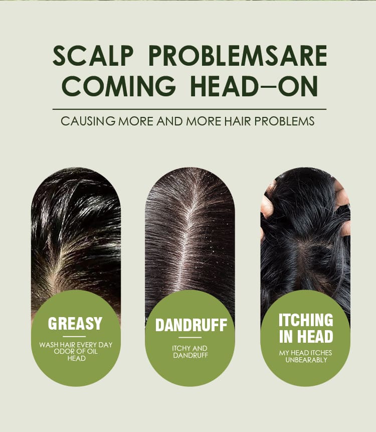 style tree tea tree hair care set – dandruff & oil control scalp treatment