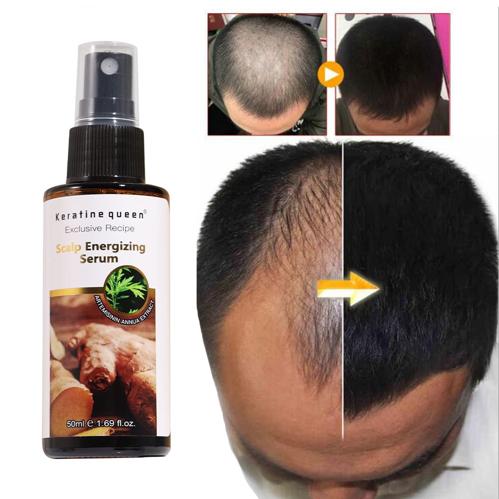 Keratine queen ginger scalp regrowth serum